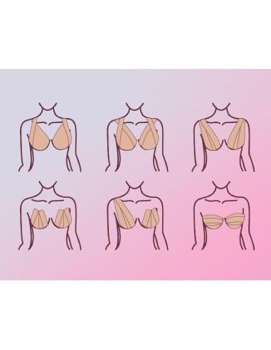 Banda adeziva pentru sustinerea si remodelarea...